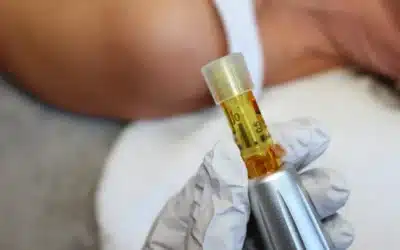 PRF: The Gold Standard in Natural Regeneration